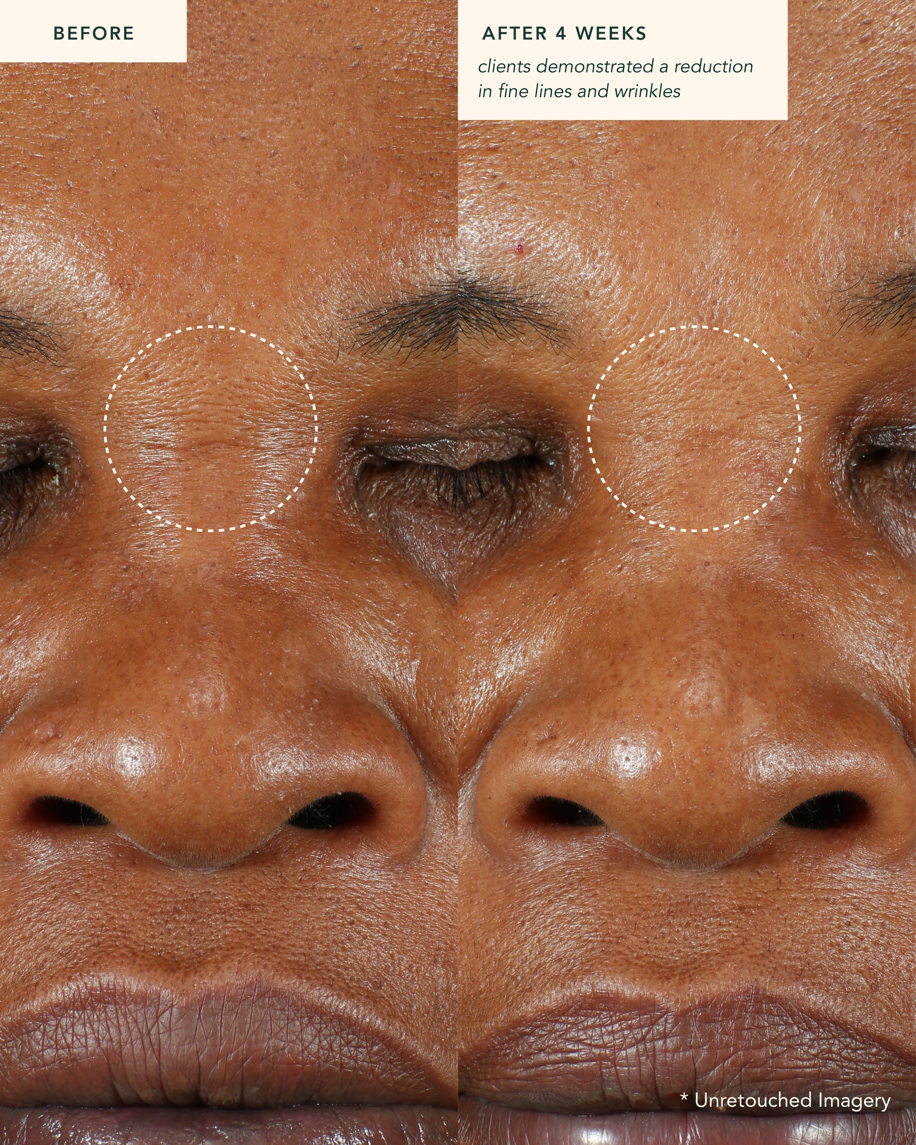 Restoring Moonseed Treatment