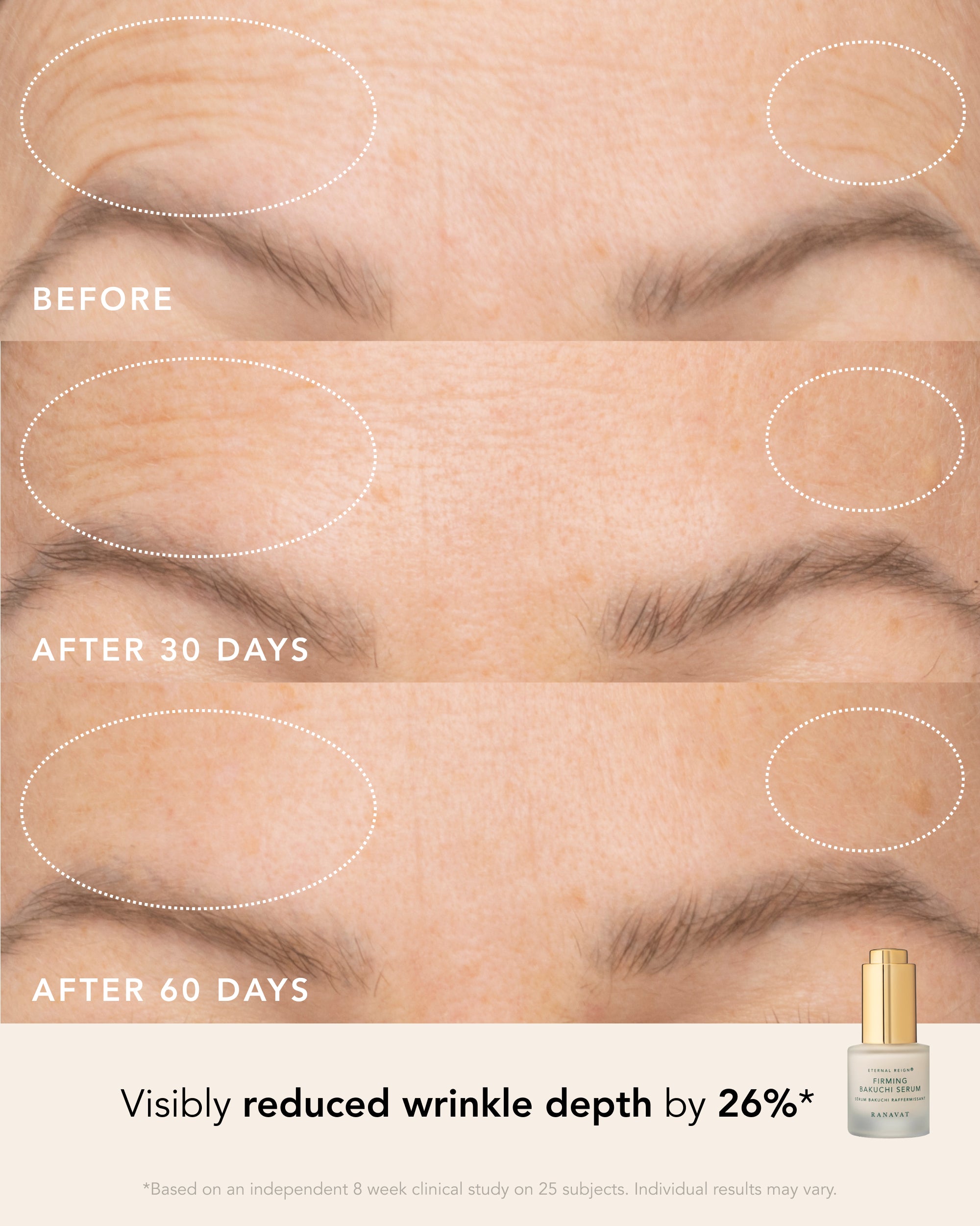Skin in Transition Set