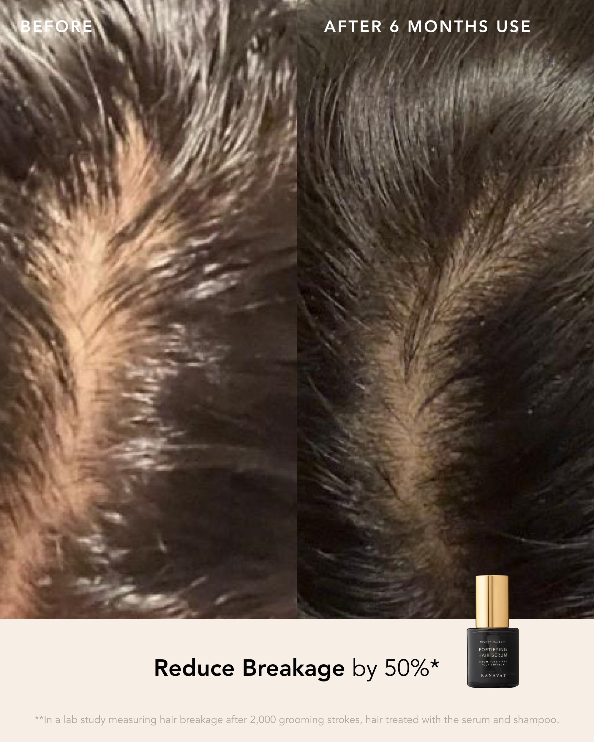 Skin in Transition Set