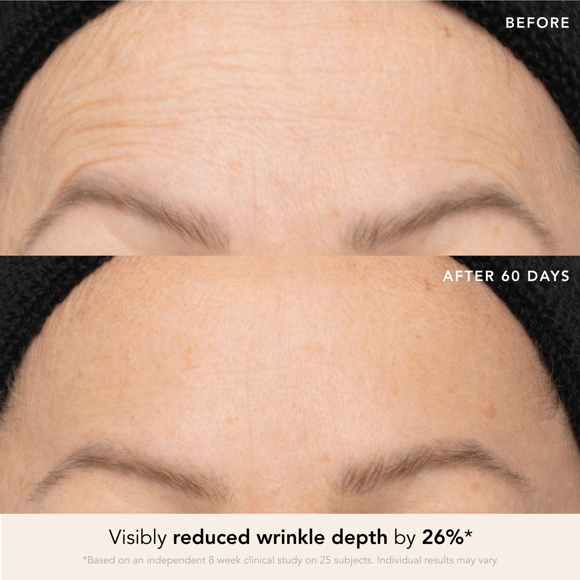 Firming Bakuchi Serum Mini (5mL)