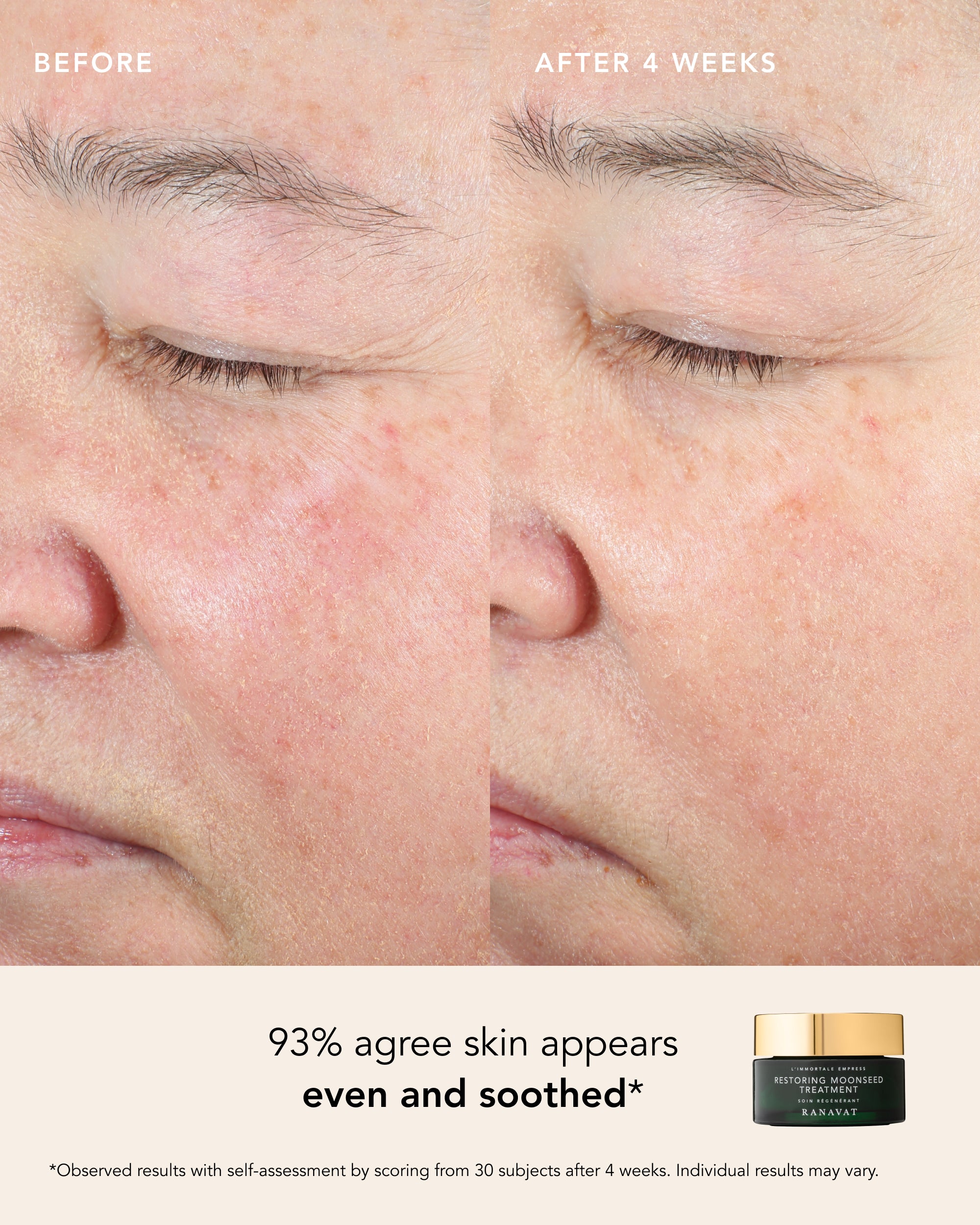 Restoring Moonseed Treatment