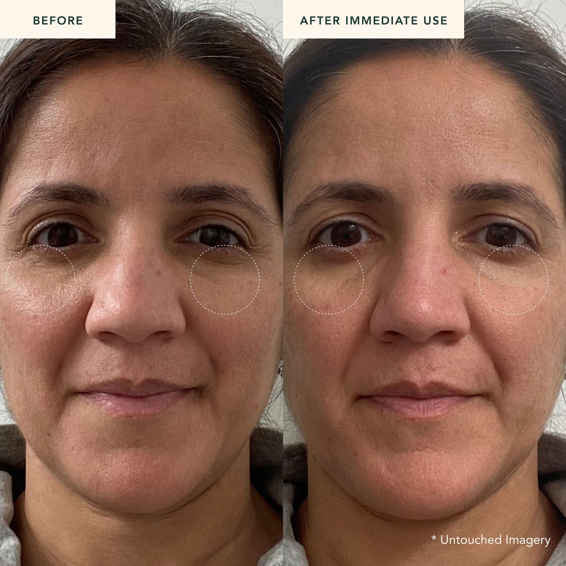 Eternal Reign - Renewing Bakuchi Crème Before and After