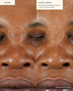 Restoring Moonseed Treatment