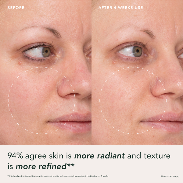 Two images comparing a woman's cheek before and after 4 weeks of using Refining Lotus Gel Creme with areas of improvement highlighted. 94% agree skin is more radiant and texture is more refined. Third party administered testing with observed results and self assessment by scoring of 34 subjects over 4 weeks. Unretouched imagery.