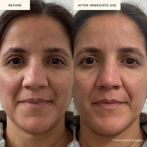 Eternal Reign - Renewing Bakuchi Crème Before and After